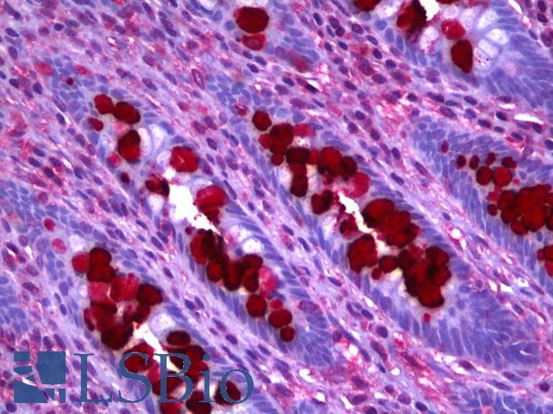 IHC-plus™ Monoclonal Mouse anti-Human GOB5 / CLCA1 Antibody (clone 1C4, IHC, WB)