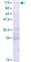 Human CC2D1A Protein (Recombinant GST)