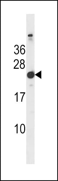 HRAS / H-Ras Antibody (aa151-179)