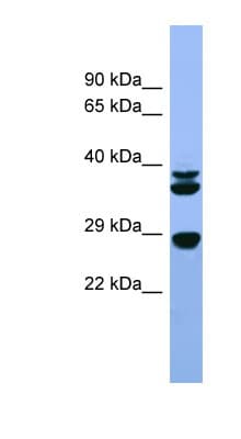 Polyclonal Rabbit anti-Rat FGF3 Antibody (aa160-209, IHC, WB)