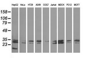 PECR Antibody (clone OTI2B2)