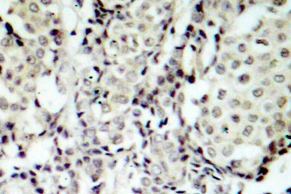 MAP2K3 / MEK3 / MKK3 Antibody (Ser183)