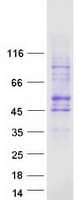 Human SLC35G2 Protein (Recombinant Myc-DDK (Flag))