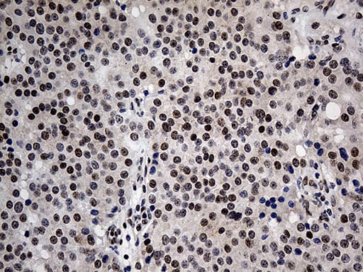 Monoclonal Mouse anti-Human MECP2 Antibody (clone OTI2F1, aa224-486, IHC, WB)