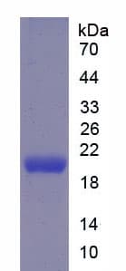 Human BPIFA2 / SPLUNC2 Protein (Recombinant His, N-Terminal)