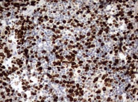 MKI67 / Ki67 Antibody (aa1160-1493, clone OTI5E6)