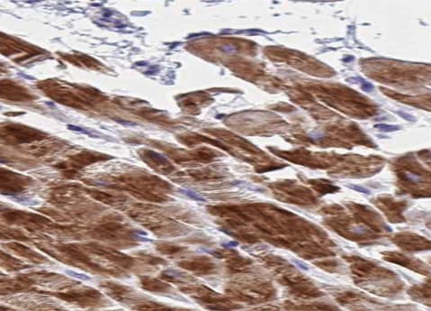 AK1 / Adenylate Kinase 1 Antibody