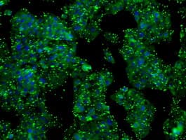 PRL / Prolactin Antibody (clone OTI9D12)