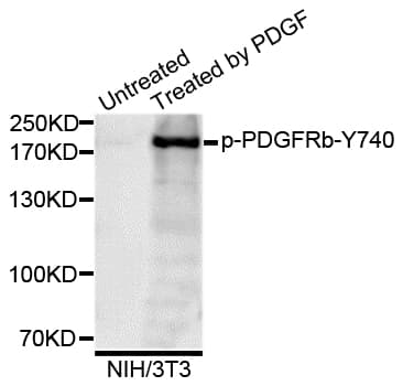 Polyclonal Rabbit anti-Human PDGFRB / PDGFR Beta Antibody (phospho-Tyr740, WB)
