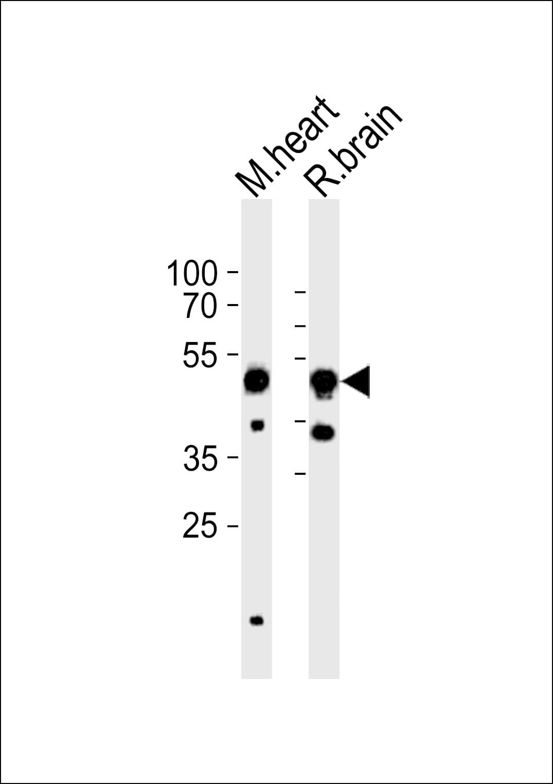 CHRNB3 Antibody (aa187-200)