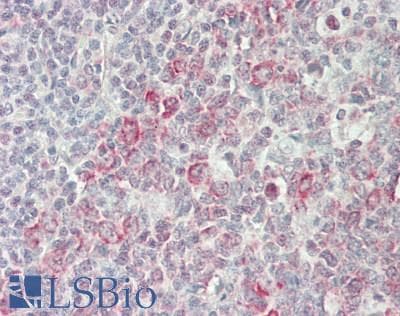 IHC-plus™ CD32C Antibody (C-Terminus)