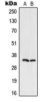 UNG / Uracil DNA Glycosylase Antibody (Internal)
