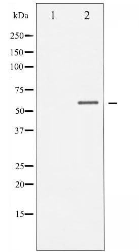 Polyclonal Rabbit anti-Human CHEK1 / CHK1 Antibody (phospho-Ser317, WB)