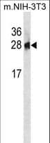 PSPH Antibody (aa7-36)