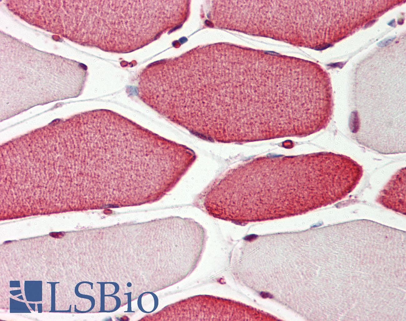 IHC-plus™ Polyclonal Rabbit anti-Human APIP Antibody (IHC, WB)