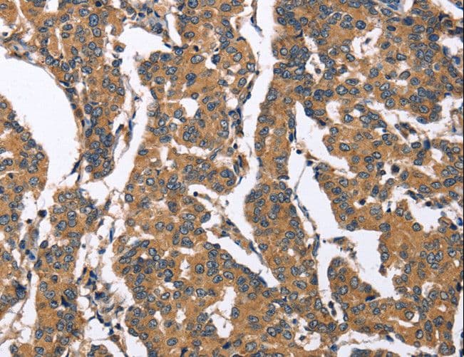 Polyclonal Rabbit anti-Human BNIP2 Antibody (IHC)
