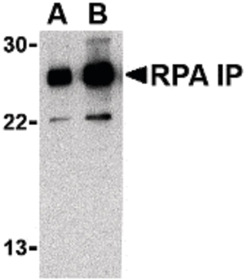 IHC-plus™ RPAIN Antibody