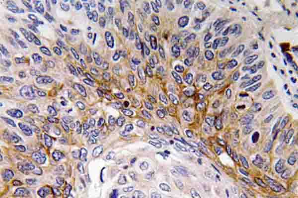CTF1 / Cardiotrophin-1 Antibody (His31)