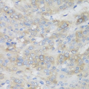 SHBG Antibody