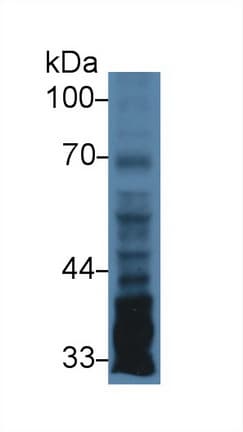 PTX3 / Pentraxin 3 Antibody (aa183-381, APC)