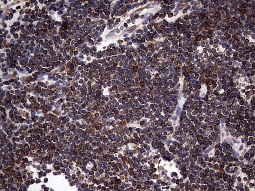 MTDH / Metadherin Antibody (aa70-582, clone OTI1B6)