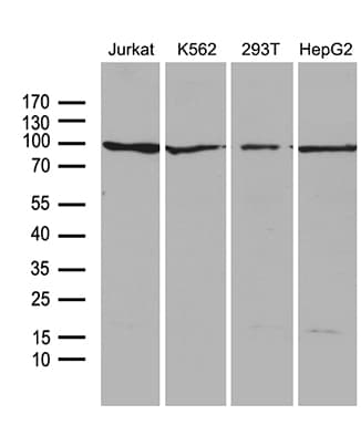 Monoclonal Mouse anti-Human PIKFYVE / PIP5K Antibody (clone OTI1D3, Carrier-free, WB)