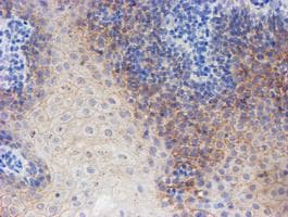 Monoclonal Mouse anti-Human ERBB2 / HER2 Antibody (clone OTI12G4, Carrier-free, aa676-1255, IHC, IF, WB)