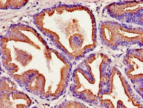 KLK2 / Kallikrein 2 Antibody