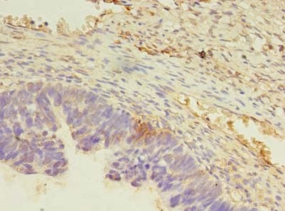 Polyclonal Rabbit anti-Human FAM32A Antibody (IHC)