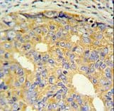 Polyclonal Rabbit anti-Human CNBP / ZNF9 Antibody (aa67-96, IHC, WB)