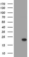 CRYAA / Alpha A Crystallin Antibody (clone OTI2C3)