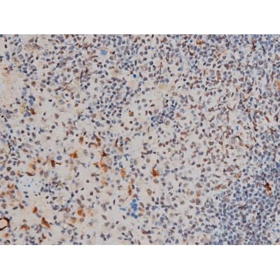 GATA1 Antibody (phospho-Ser142)