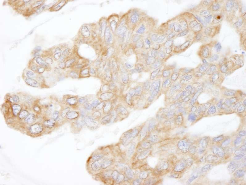 KIAA1524 / p90 Autoantigen Antibody (aa550-600)