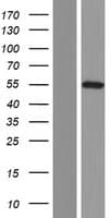 CACNB1 Protein (Over-Expression Lysate Myc-DDK (Flag))