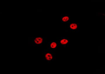 Polyclonal Rabbit anti-Human Histone H3 Antibody (Acetyl-Lys18, IHC, IF, WB)