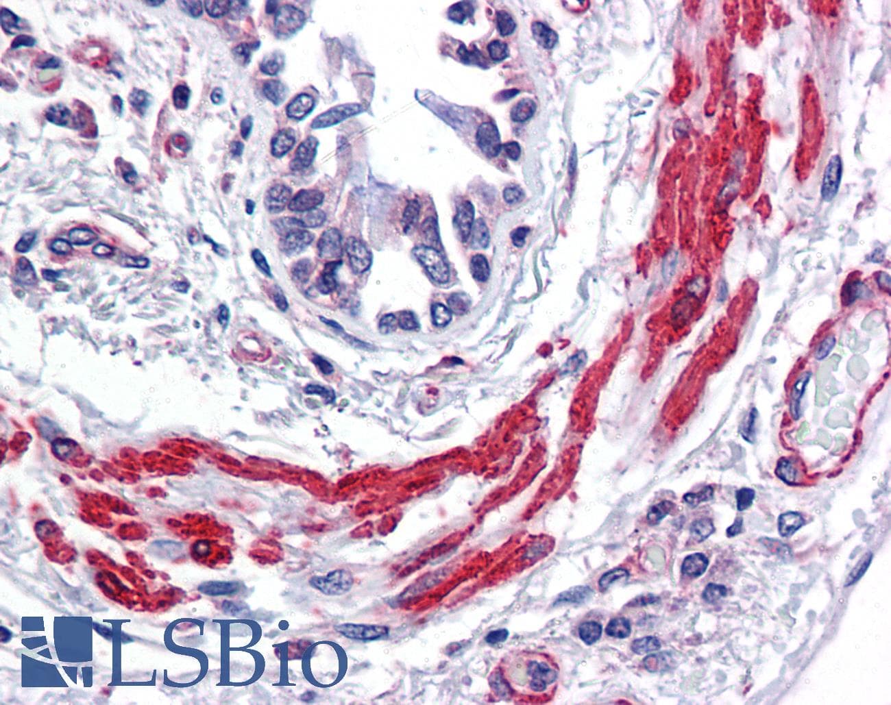 PathPlus™ Polyclonal Rabbit anti-Human ACTA1 / Skeletal Muscle Actin Antibody (IHC, WB)