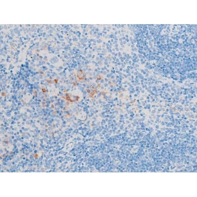 LIMK1 / LIMK Antibody (phospho-Thr508,pThr505)