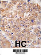 Polyclonal Rabbit anti-Human UVRAG Antibody (aa120-152, IHC, IF, WB)