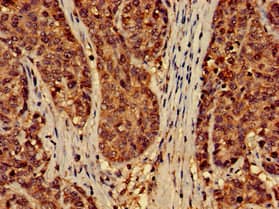 EFHD2 Antibody