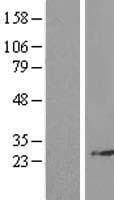RPL14 / Ribosomal Protein L14 (Over-Expression Lysate Myc-DDK (Flag))