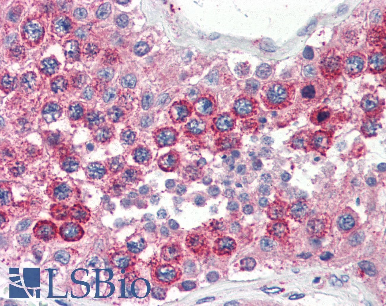 IHC-plus™ VAMP2 / VAMP-2 Antibody (aa1-89, clone 3E5)
