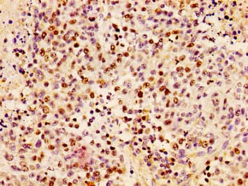 HIST1H1B Antibody