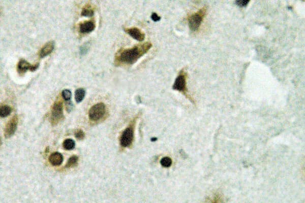 GTF3C3 Antibody (Glu131)
