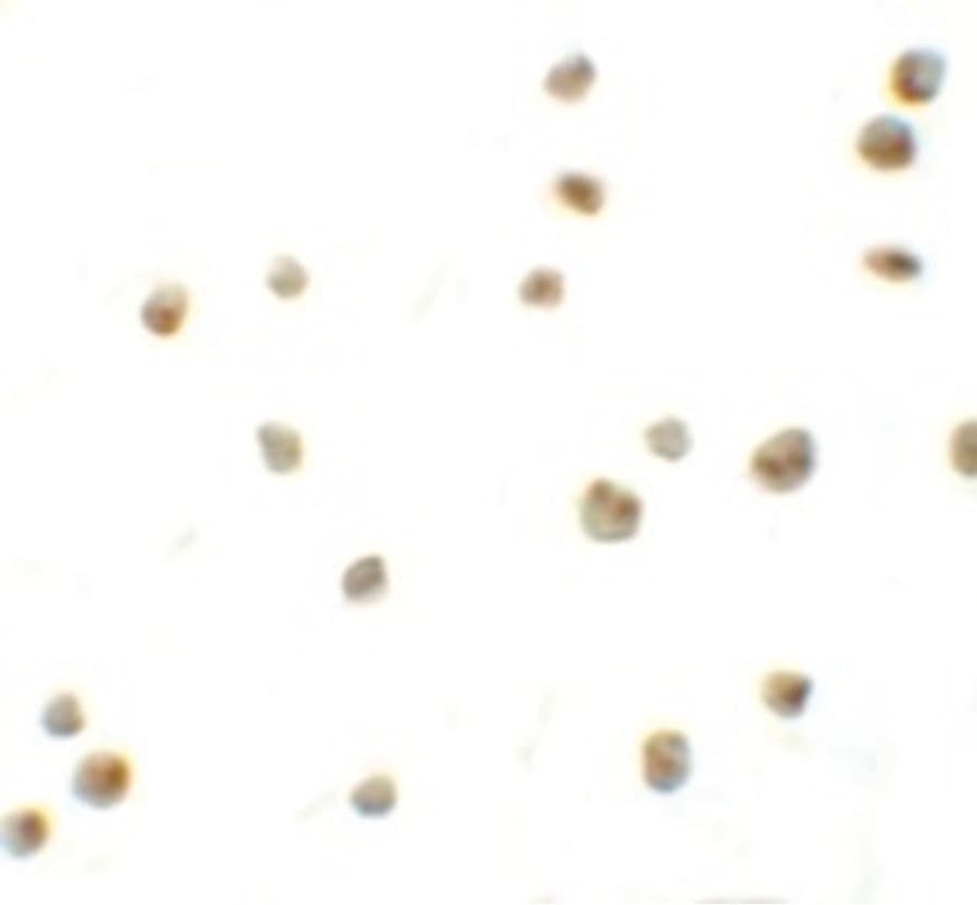 IHC-plus™ Polyclonal Rabbit anti-Human DYRK2 Antibody (IHC, IF, WB)