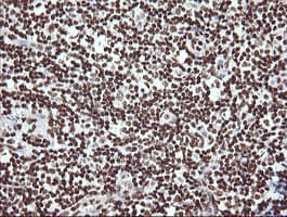 THUMPD1 Antibody (clone OTI1H6)