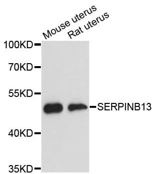 SERPINB13 / HUR7 Antibody
