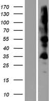 ZDHHC19 Protein (Over-Expression Lysate Myc-DDK (Flag))