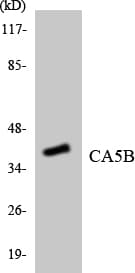 CA-VB / CA5B Antibody (aa231-280)