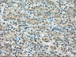 Monoclonal Mouse anti-Human SSB / La Antibody (clone OTI6G7, IHC, IF, WB)
