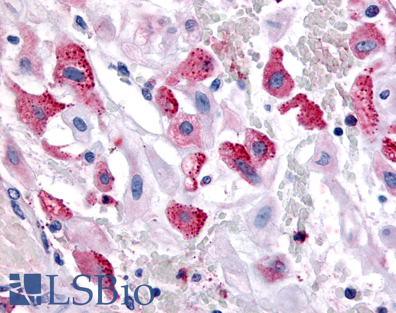 IHC-plus™ Polyclonal Rabbit anti-Human BRS3 Antibody (Cytoplasmic Domain, IHC)